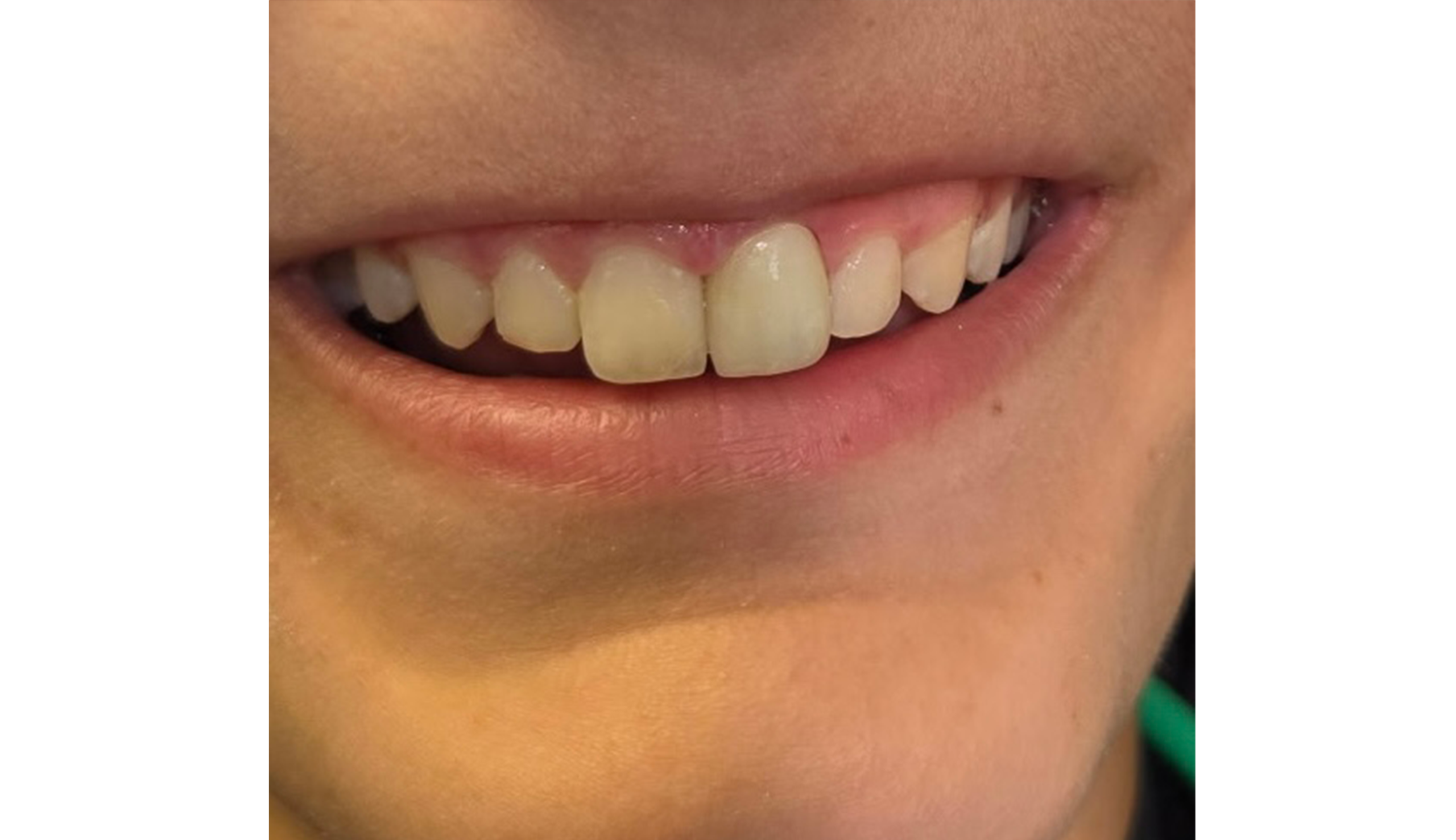 After